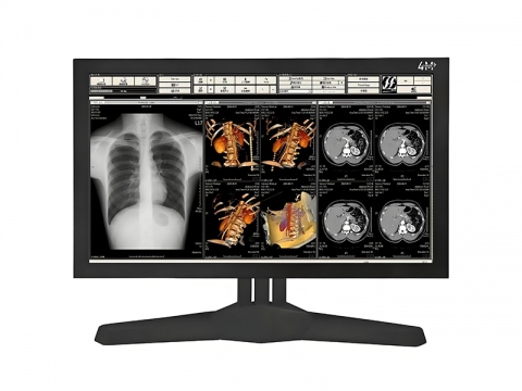 27寸手术室医疗显示器