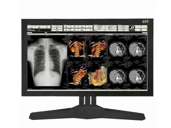 27寸手术室医疗显示器：如何成为多模态影像中枢