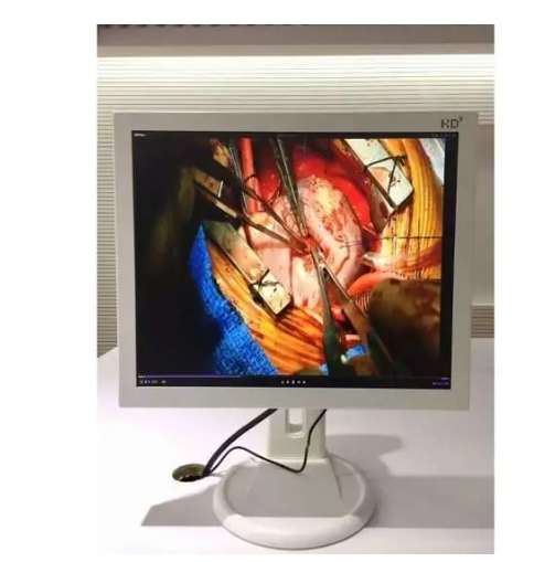 15寸手术室医疗显示器