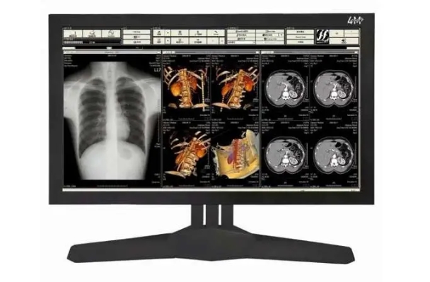 27寸手术室医疗显示器：如何成为多模态影像中枢